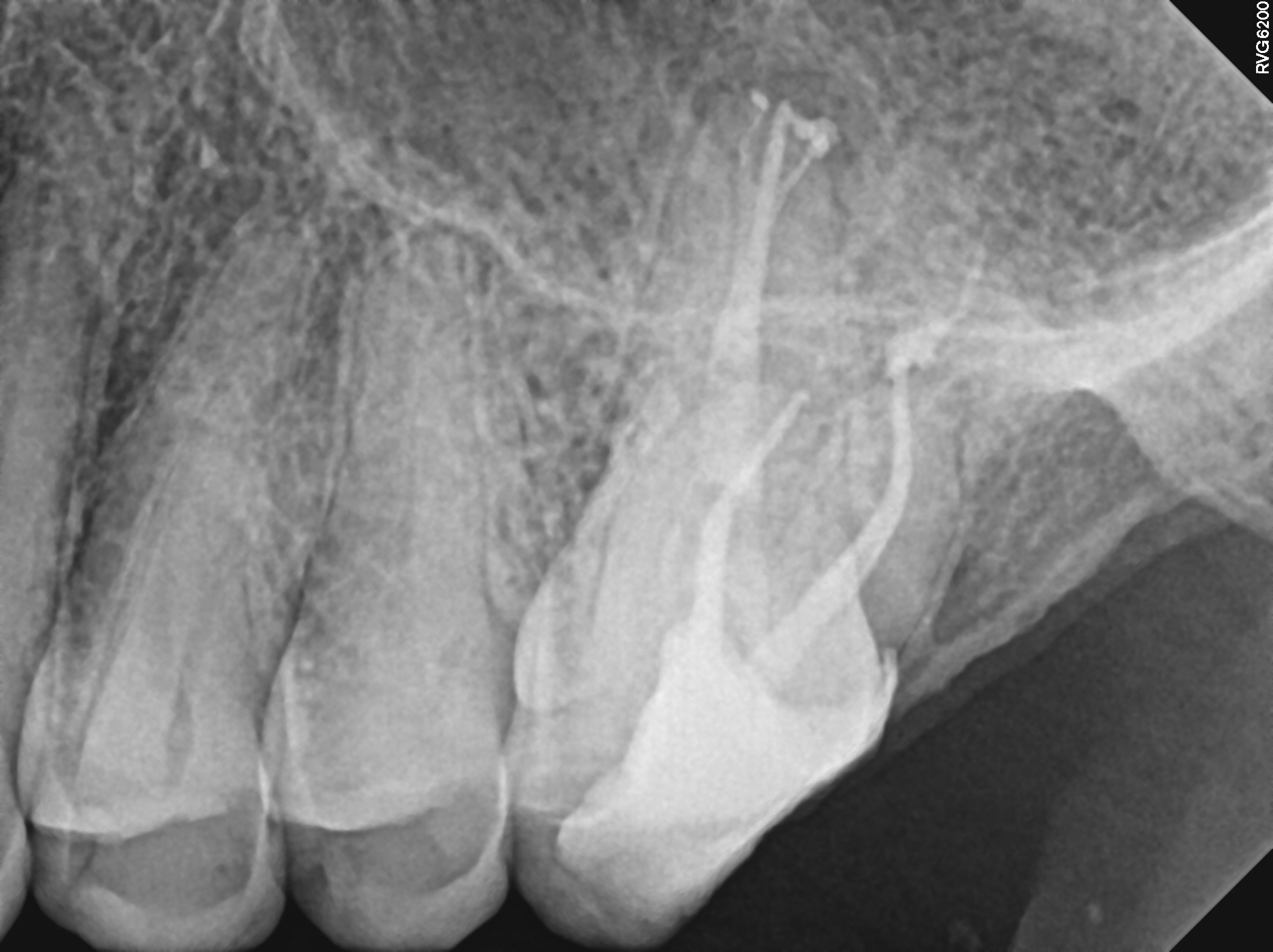 2_post2 (3 POEs seen)