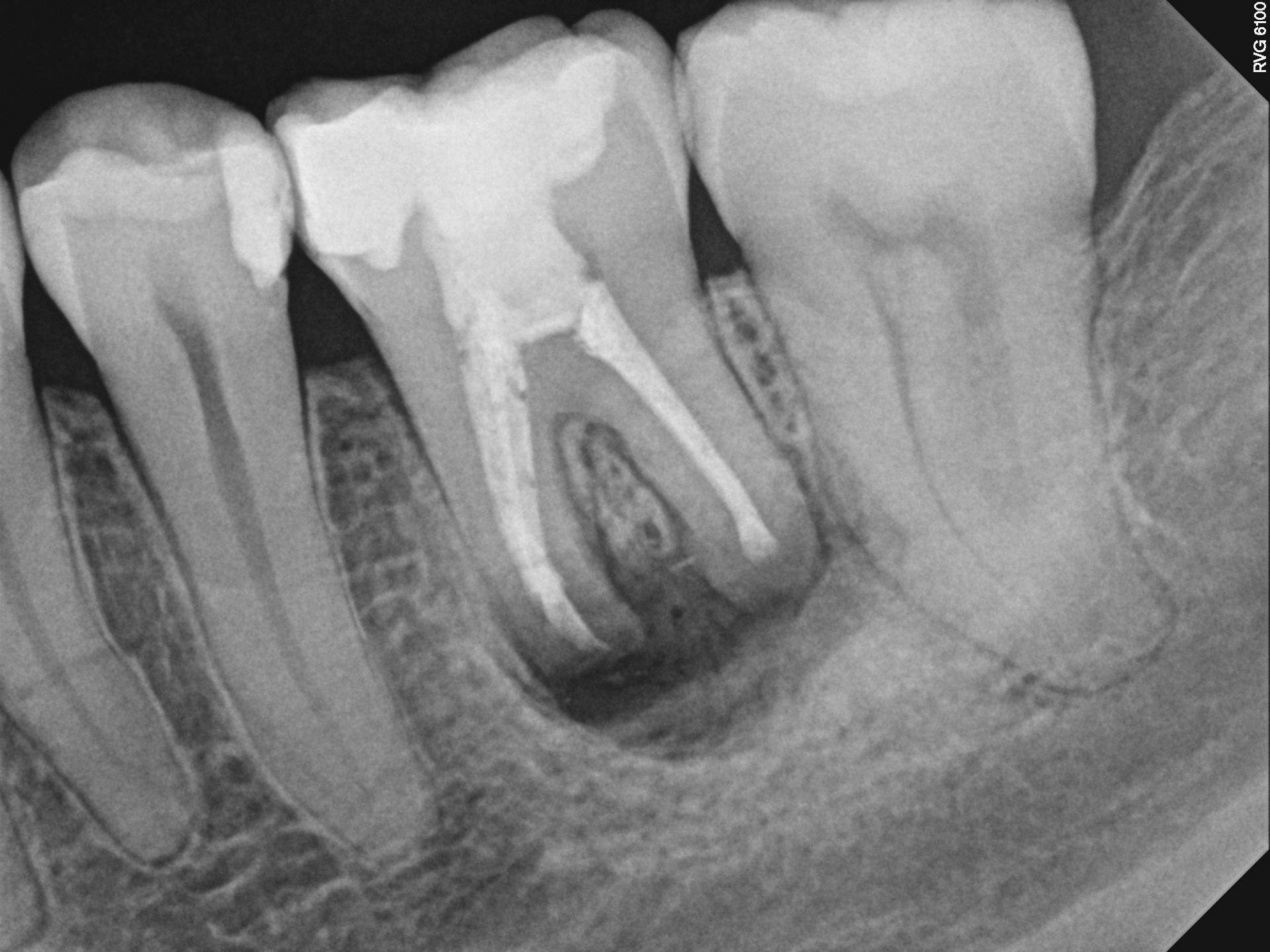11_Case7 PostOp1 12-11-2014