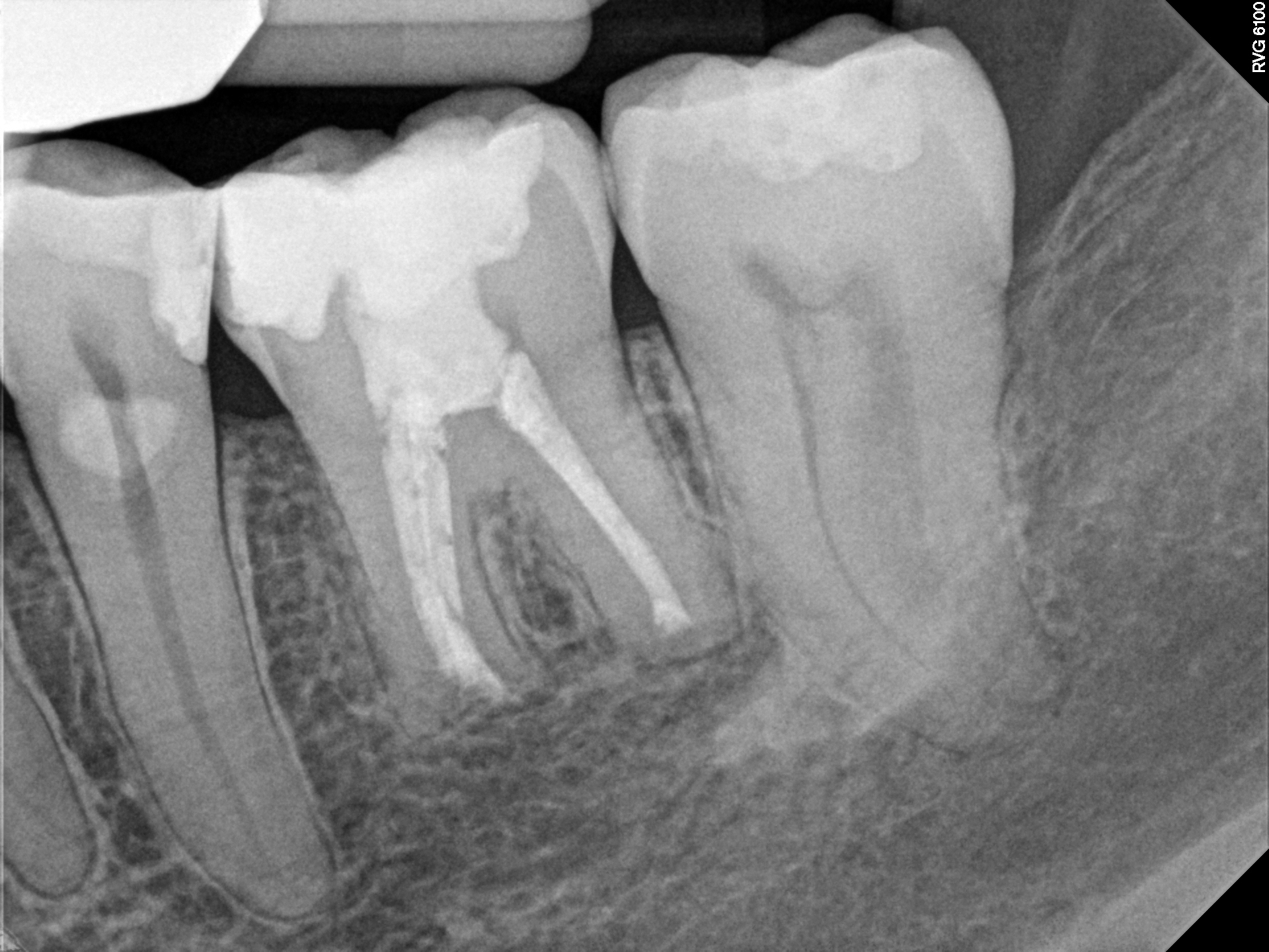 14_Case7 Recall2 9-27-2016