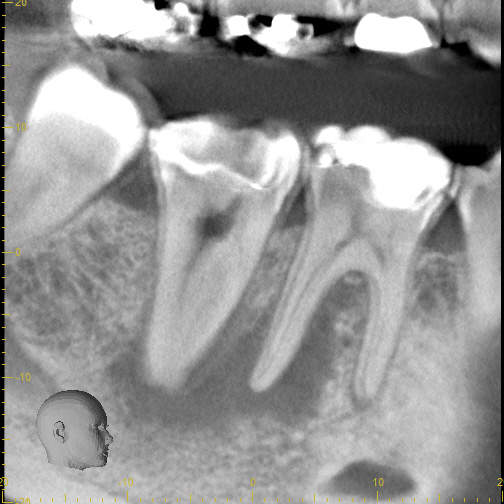 3_pre CBCT